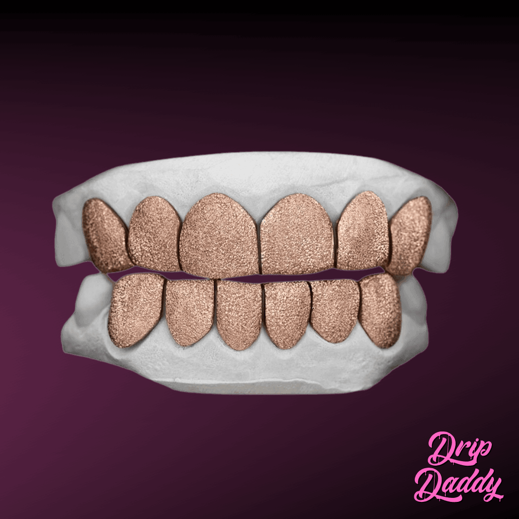 Diamond dust grillz in rose gold plating with full top and bottom coverage, crafted from 925 sterling silver by Drip Daddy.