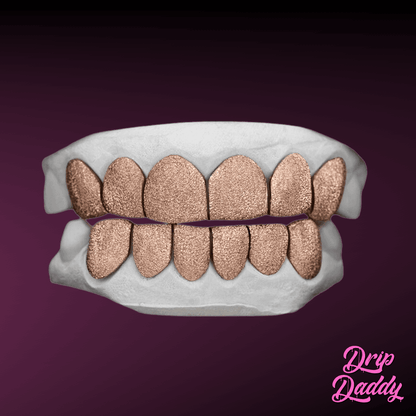 Diamond dust grillz in rose gold plating with full top and bottom coverage, crafted from 925 sterling silver by Drip Daddy.