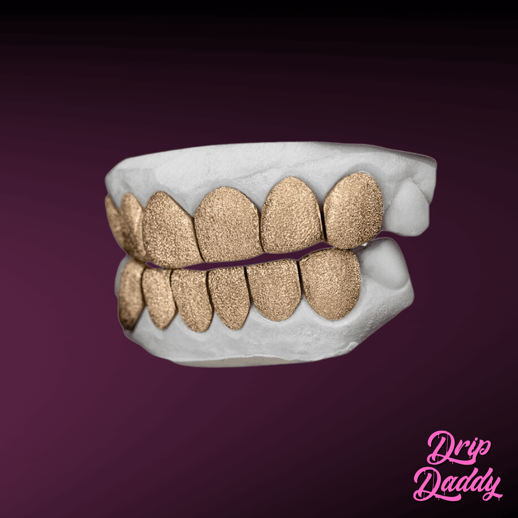 Diamond dust grillz with yellow gold plating over 925 sterling silver, custom full set with sparkling textured design by Drip Daddy.